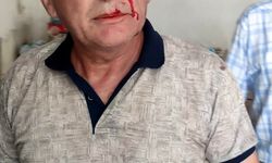 Osmaniye Belediye Başkanı Kaynar'a dayısı saldırdı