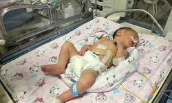 Annesi kazada ölüp sezaryenle dünyaya gelen bebek hayata tutundu
