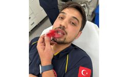 Bursa'da ambulans şoförüne feci darp!