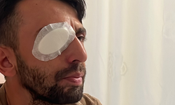 Balkondan açılan ateşte gözünden yaralanan işçi: "Sağ gözümden oldum"