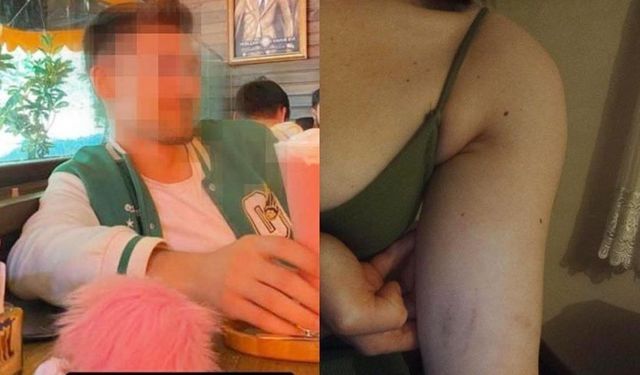 Zonguldak'ta cinsel ilişki teklifini reddeden sevgilisini döven şahıs serbest!