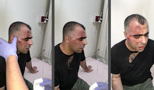Bitlis'te Sinan Aygül'e saldırı: Belediye çalışanı ile bir polis açığa alındı