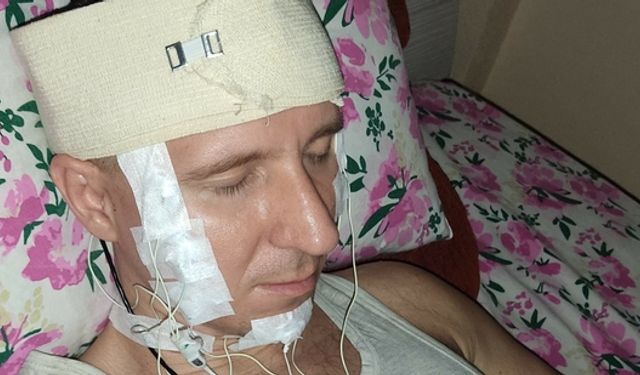 Rusya'da rüyalarını kontrol etmek isteyen adam kafasını matkapla deldi
