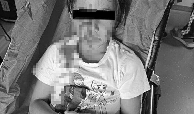 Esenyurt’ta başıboş köpek site bahçesinde oynayan 6 yaşındaki İkra Su Eviz'e saldırdı