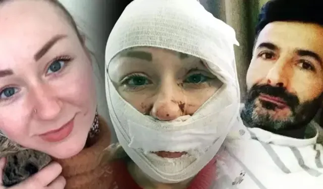 Ukraynalı eşinin yüzünü falçatayla kesen şahıs tahliye edildi
