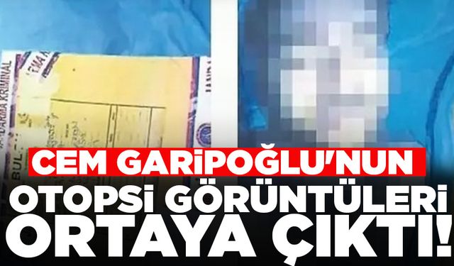 Cem Garipoğlu'nun otopsi görüntüleri ortaya çıktı!