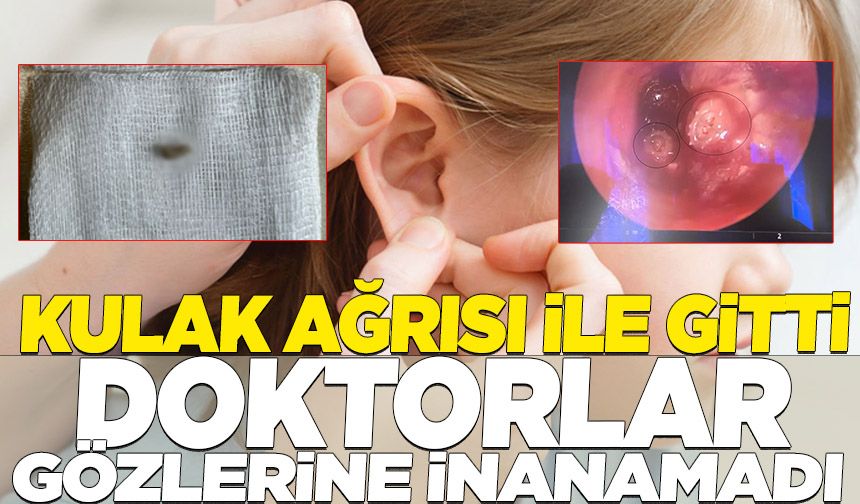 Bursa'da çocuğun kulağından çıkan kurtçuklar doktorları da şaşırttı