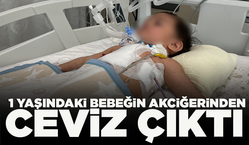1 yaşındaki bebeğin akciğerinden ceviz çıktı